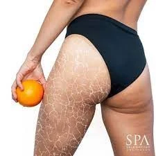 BioPulse Body | Peg's Beautysalon Zevenaar
